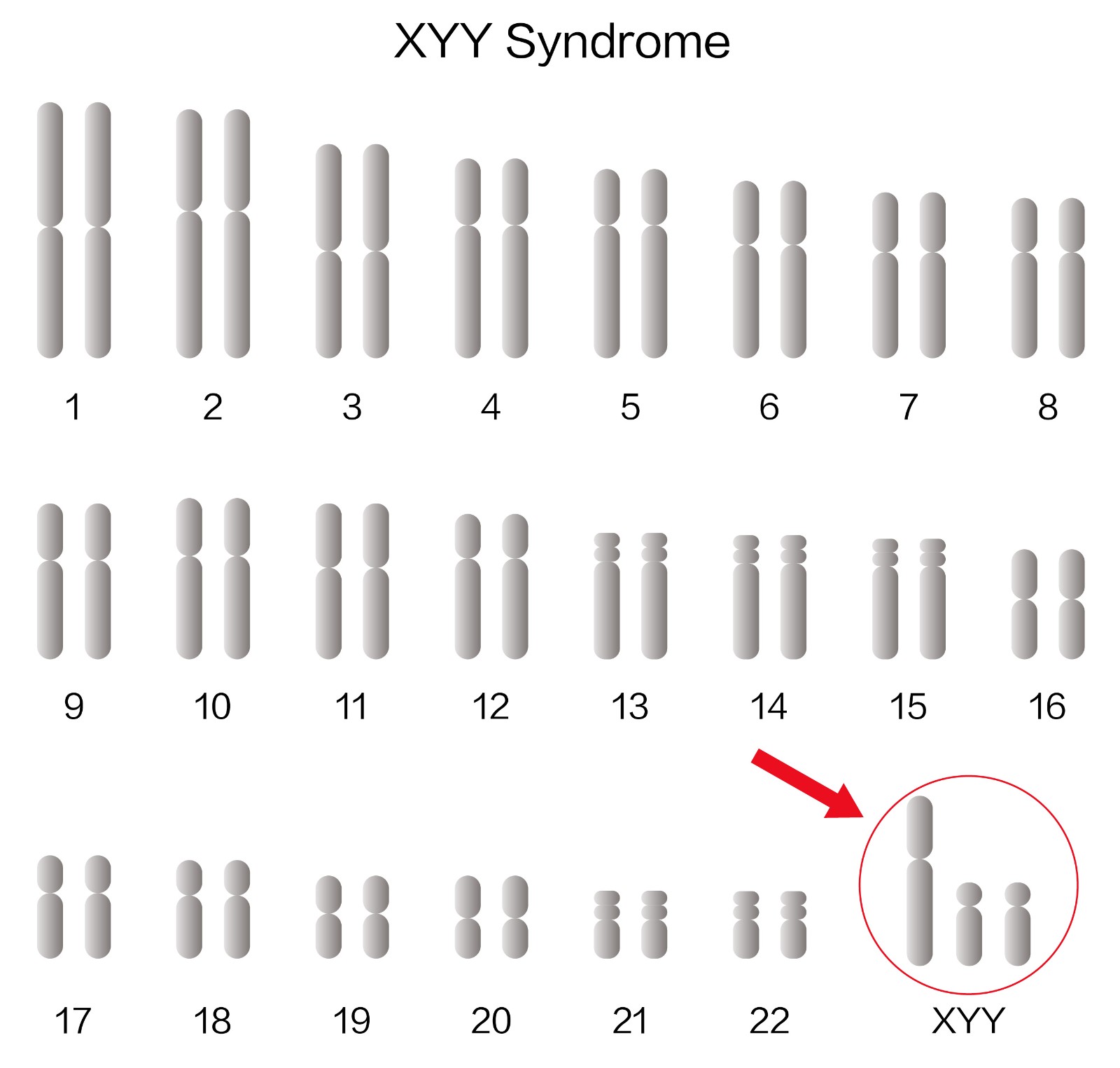 1721981441995347.jpg ³¬ÐÛ×ÛºÏÕ÷»¼ÕßȾɫÌåºËÐÍ.jpg