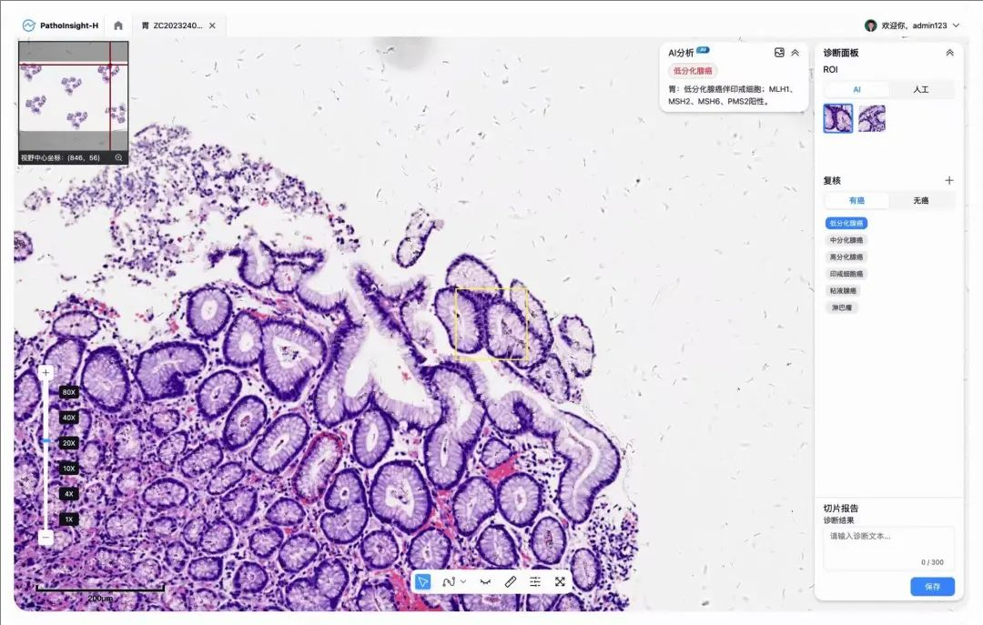 �ü���ת (11).jpeg